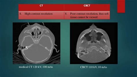cbct vs ct|difference between ct and cbct.